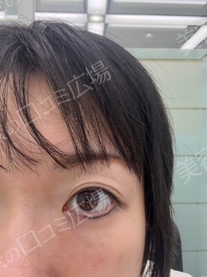 筋肉・美容クリニックの症例写真[アフター]