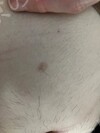 施術後の状態