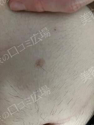 ブリスクリニックの症例写真[アフター]