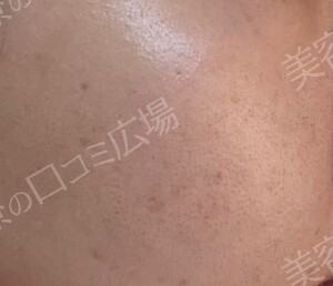 治療前の症例写真