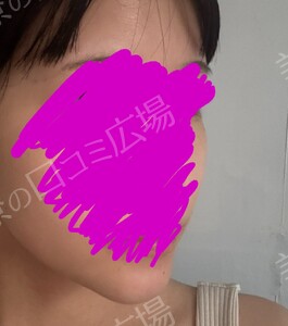 治療前の症例写真