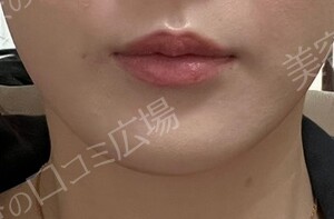 治療前の症例写真