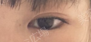 治療前の症例写真