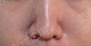 治療前の症例写真