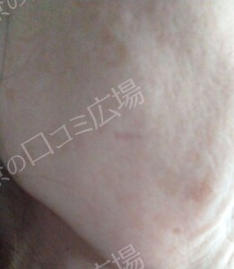 治療前の症例写真