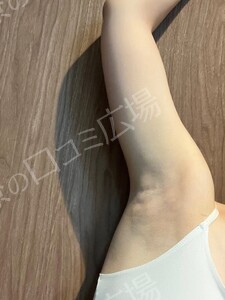 治療前の症例写真