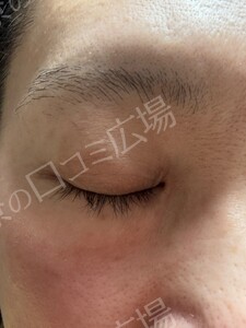 治療前の症例写真