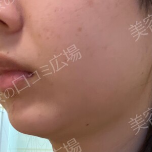 治療前の症例写真