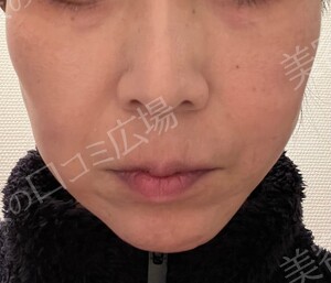 治療結果の症例写真
