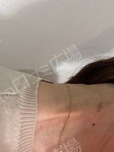 治療結果の症例写真