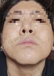 治療結果の症例写真