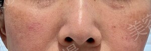 治療結果の症例写真