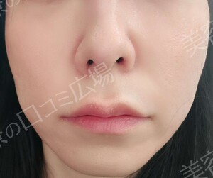 治療前の症例写真