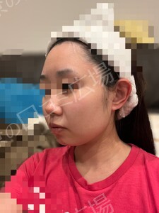 治療前の症例写真