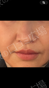 治療前の症例写真