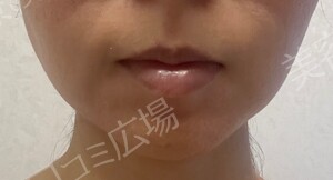 治療前の症例写真
