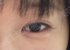 治療結果の症例写真