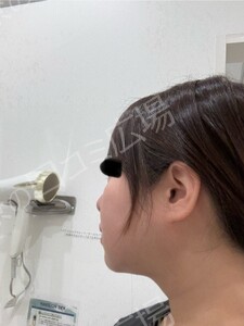 治療前の症例写真