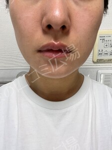 治療結果の症例写真