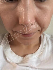 治療結果の症例写真