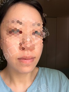 治療結果の症例写真