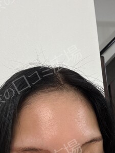治療結果の症例写真