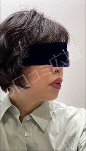 治療結果の症例写真