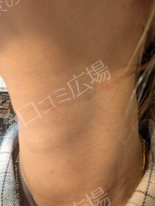 治療前の症例写真
