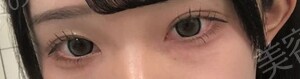 治療前の症例写真