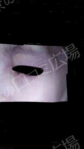 治療前の症例写真