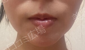ルラ（LULA）美容クリニック 沖縄院の症例写真[アフター]