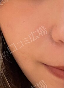 治療前の症例写真