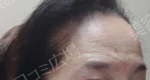 治療結果の症例写真