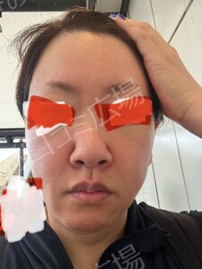 治療結果の症例写真