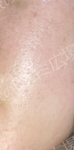 治療結果の症例写真