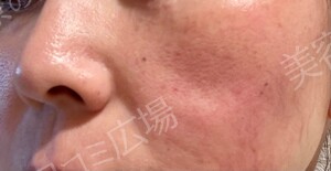 治療前の症例写真