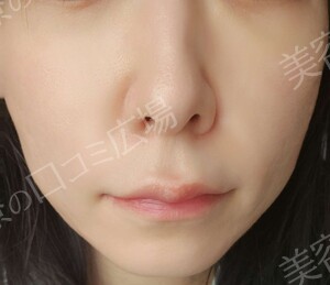 治療結果の症例写真