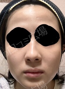 治療結果の症例写真