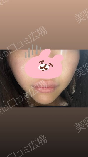 ギャラリークリニックの症例写真[アフター]