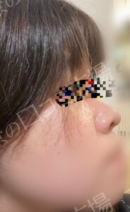 治療前の症例写真