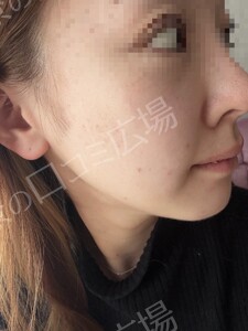 治療結果の症例写真