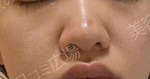 治療結果の症例写真