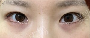 治療結果の症例写真