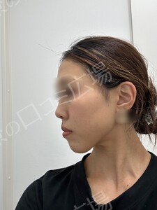 治療前の症例写真