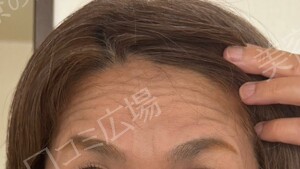 治療前の症例写真