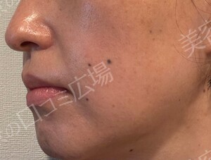 治療前の症例写真