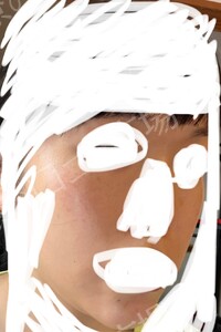 治療前の症例写真
