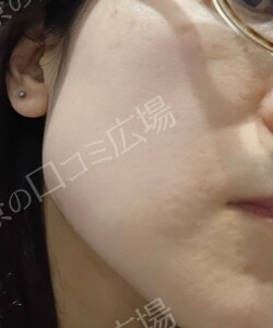 治療前の症例写真