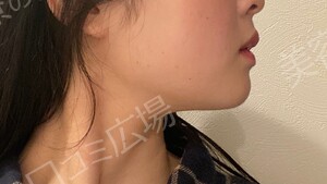 治療前の症例写真