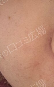 治療結果の症例写真